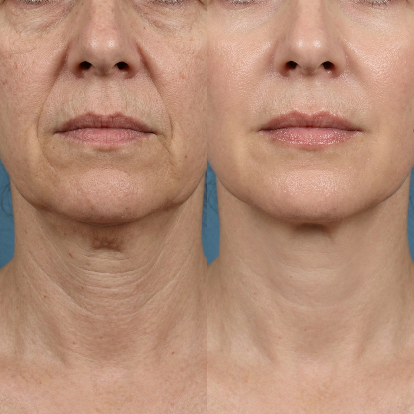 Peptide Anti-Aging Serum