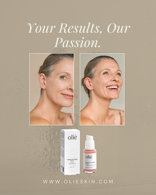 Glycation and Skin Aging: How Sugar Destroys Collagen (And How to Stop It)