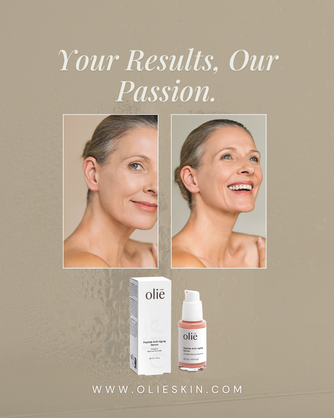 Skin Elasticity After 40: How to Actually Restore It