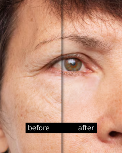 before_after-2.png__PID:4627f58a-3e76-48e6-9ab2-46e683a4d73a