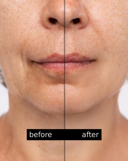 before_after.png__PID:9364ba32-dbc0-47c9-af17-48c22f591dc3