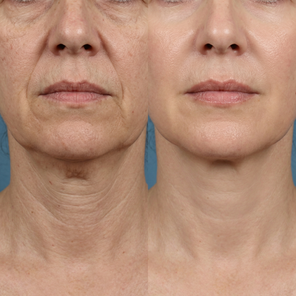 Peptide Anti-Aging Serum